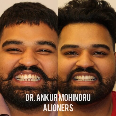 Dr. Ankur Mohindru | Best dentist in amritsars