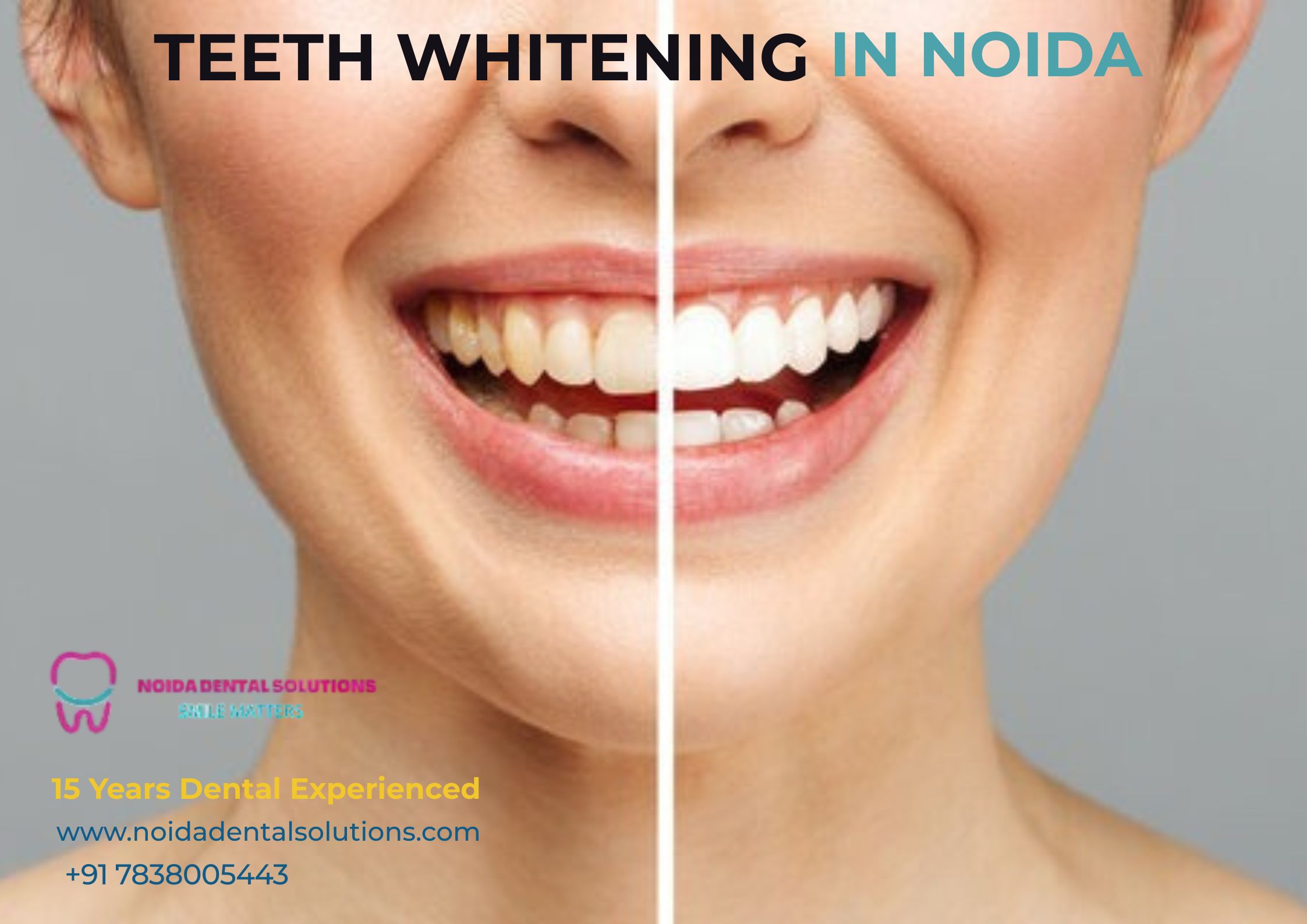 Noida Dental Solutions
