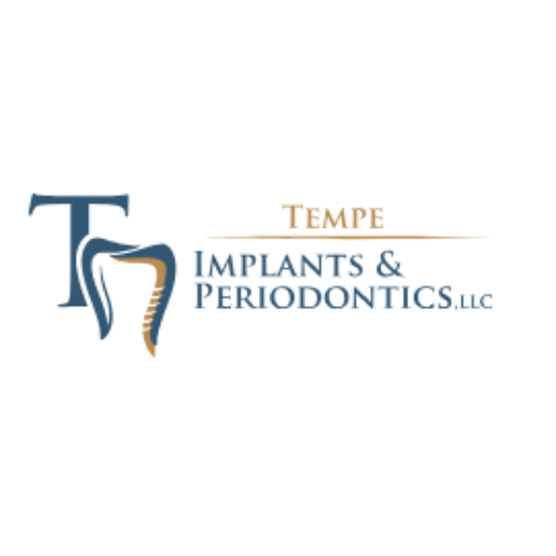 What’s the cost of dental implants in Ahwatukee Foothi