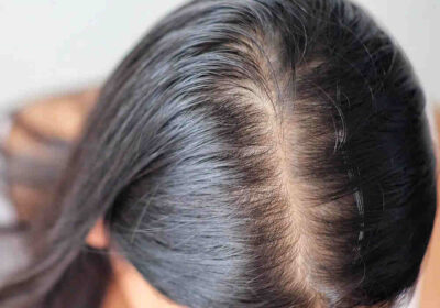 hair-loss-treatment-new