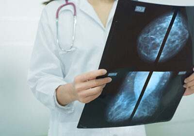 Breast-Cancer-Screening-and-Diagnosis-by-Melanie-Seah